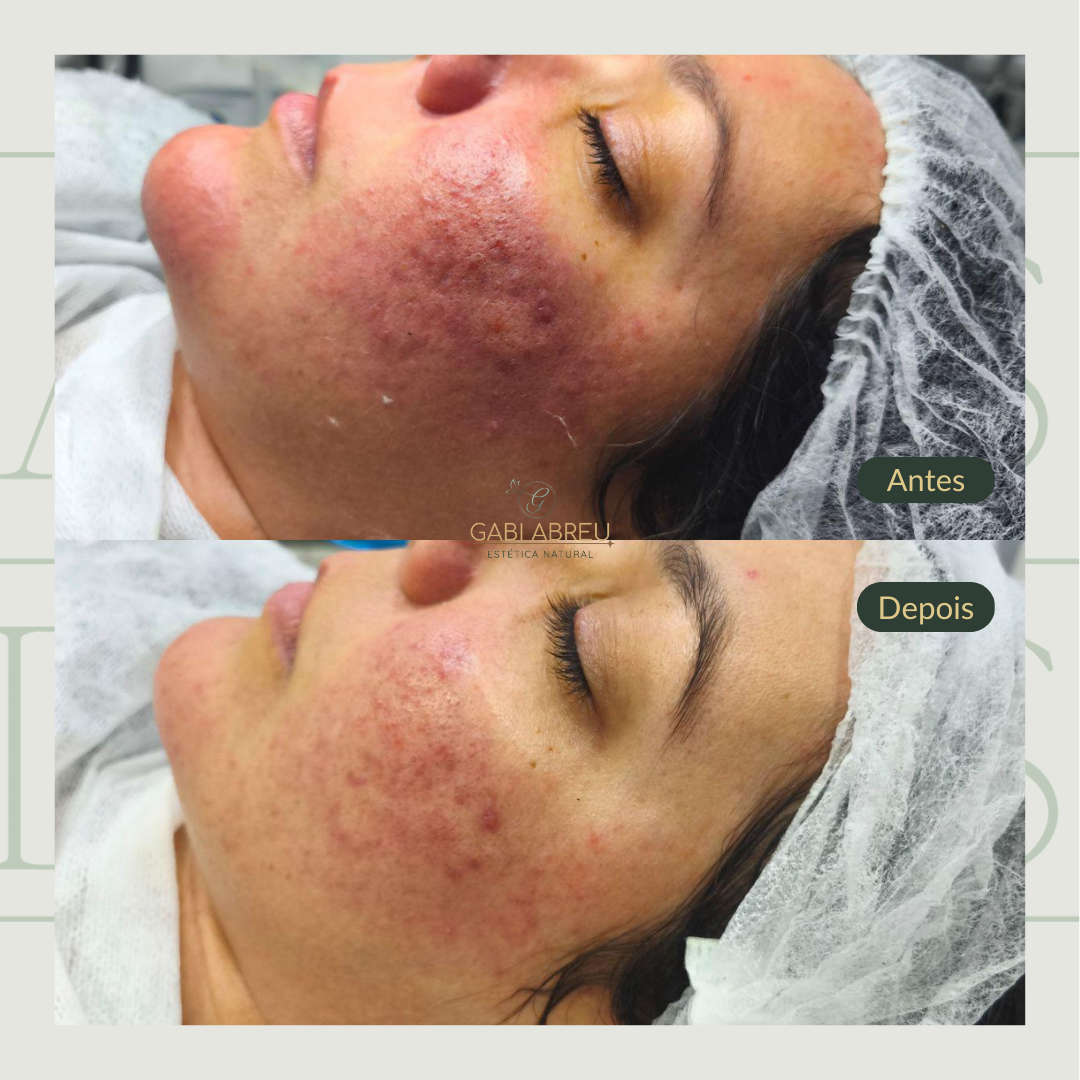 Resultado antes e depois — cliente 2