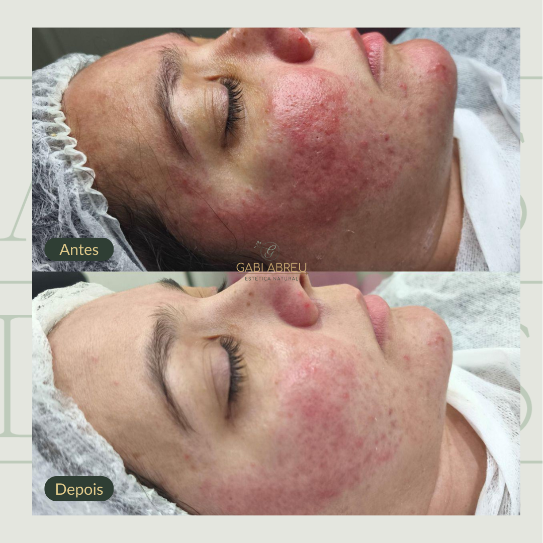 Resultado antes e depois — cliente 2