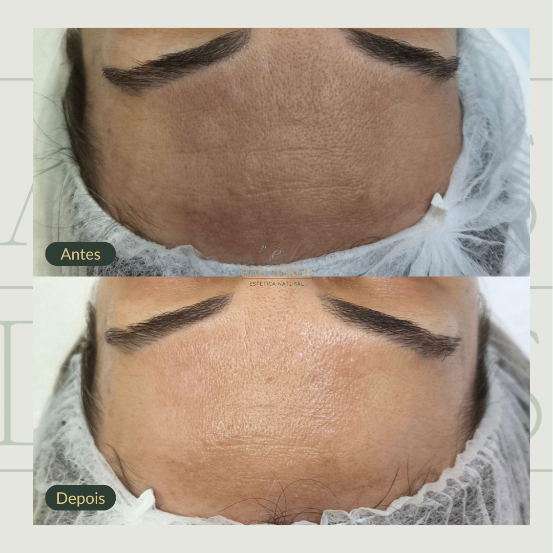 Resultado antes e depois — cliente 3