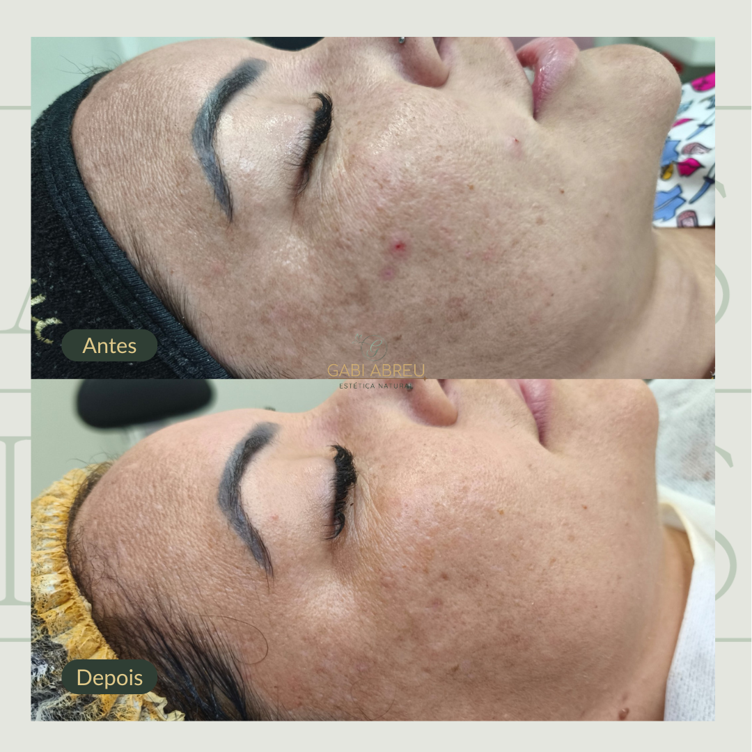 Resultado antes e depois — cliente 3