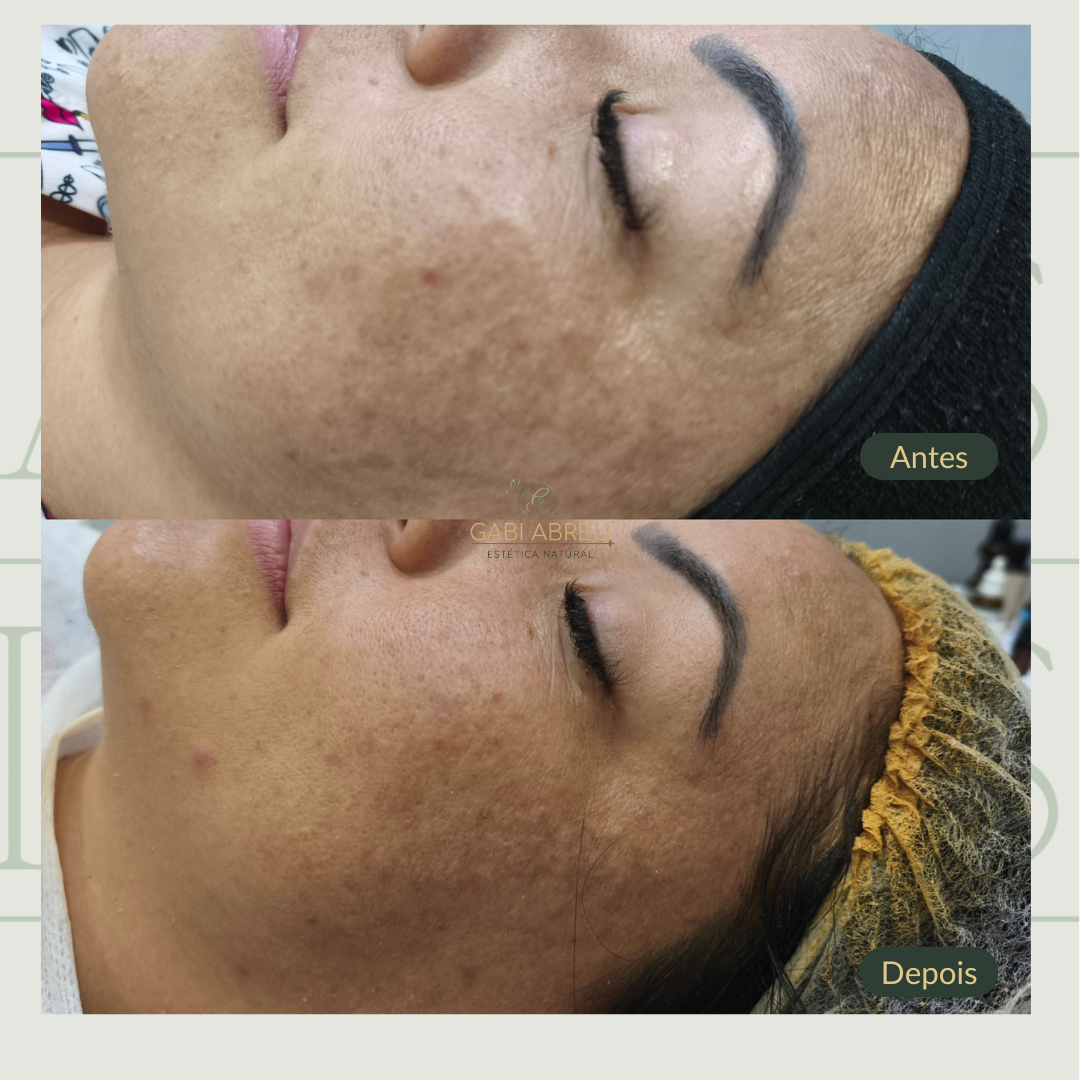 Resultado antes e depois — cliente 3